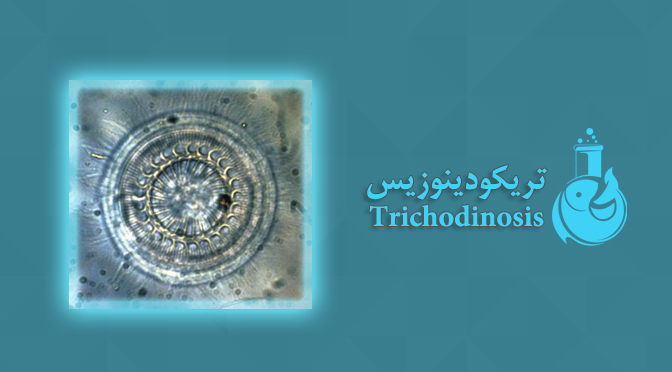 تریکودینوزیس - Trichodinosis