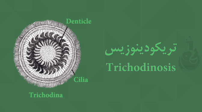 بیماری تریکودینوزیس - Trichodinosis