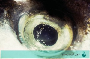 آمبولی گازی در چشم / بیماری حباب گازی